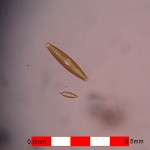 Free swimming pennate diatoms Free swimming pennate diatoms